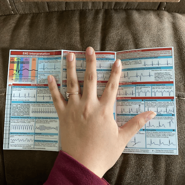 EKG Pocket Guide
