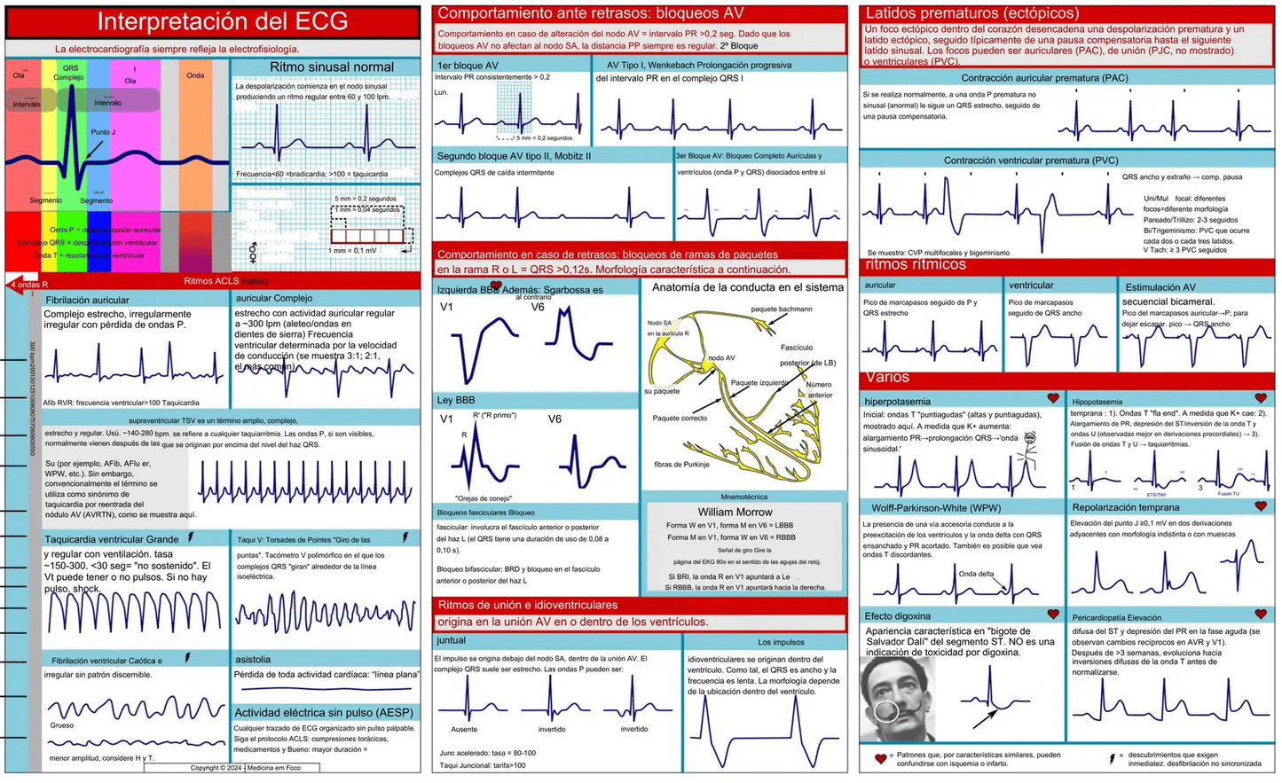 EKG Pocket Guide