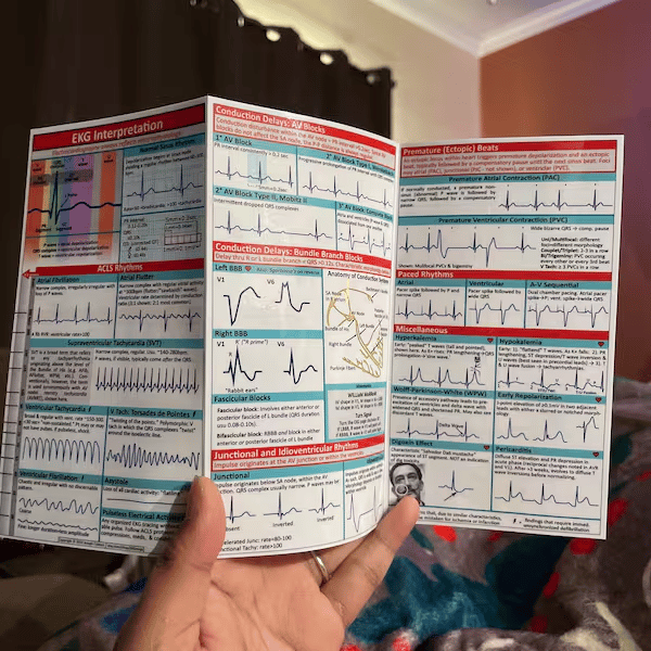 EKG Pocket Guide