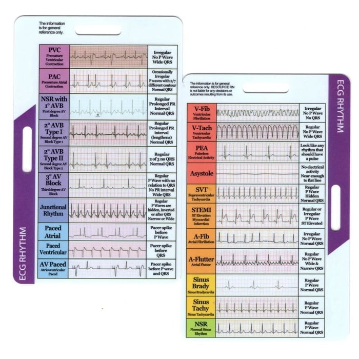 EKG Pocket Guide