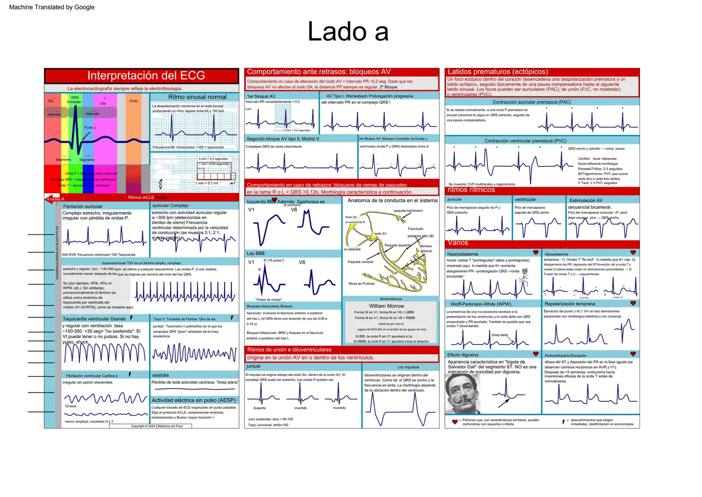 EKG Pocket Guide