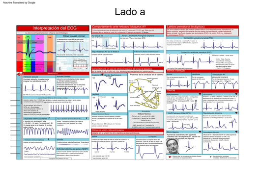 EKG Pocket Guide